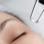 Pico-Laser-for-Pigmentation-How-It-Helps-with-Melasma,-Dark-Spots,-and-More