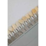 Are Dental Implants the Best Way to Replace Missing Teeth?