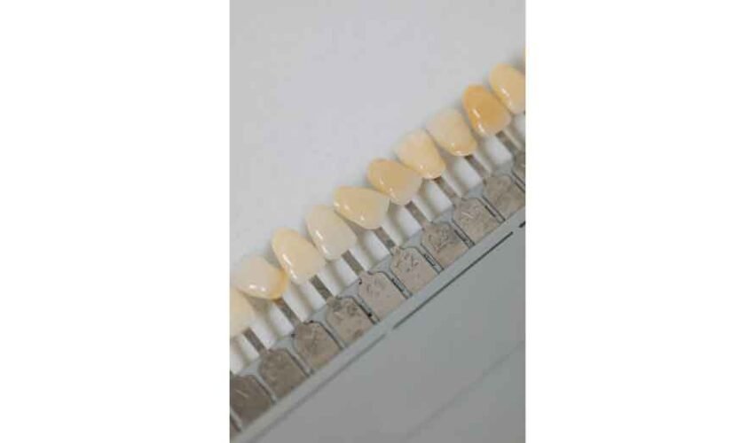 Are Dental Implants the Best Way to Replace Missing Teeth?