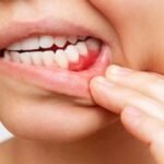 Why Your Gums Deserve a Specialist (Not Just a Dentist)