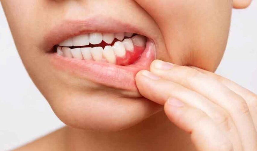 Why Your Gums Deserve a Specialist (Not Just a Dentist)