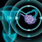 Why LGSOC Day Matters for Women’s Health