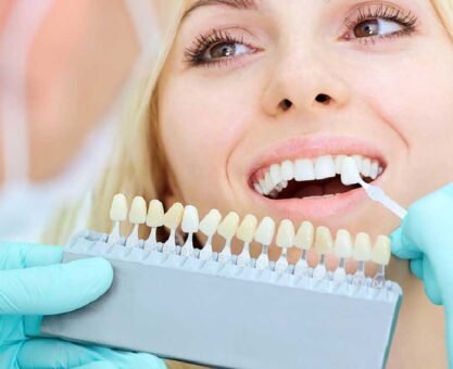 7 Things That Ruin Your Teeth Whitening Results