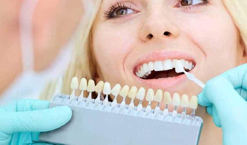 7 Things That Ruin Your Teeth Whitening Results
